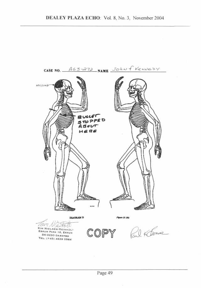 [Image: Oconnor%20intercostal%20muscle%20bullet_zpsbeelszpz.jpg]